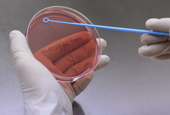 Ученые используют ДНК-пробу для того, чтобы обнаружить дизентерийную бактерию