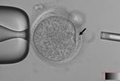 Эмбриональные стволовые клетки впервые клонированы при помощи зрелых клеток