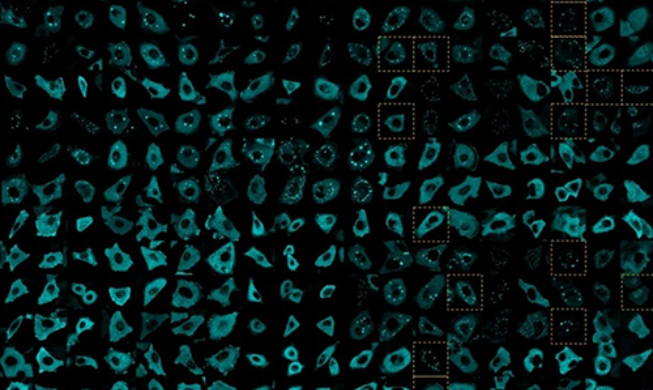 ﻿Корейско-американская исследовательская группа раскрыла «секрет миграции раковых клеток»